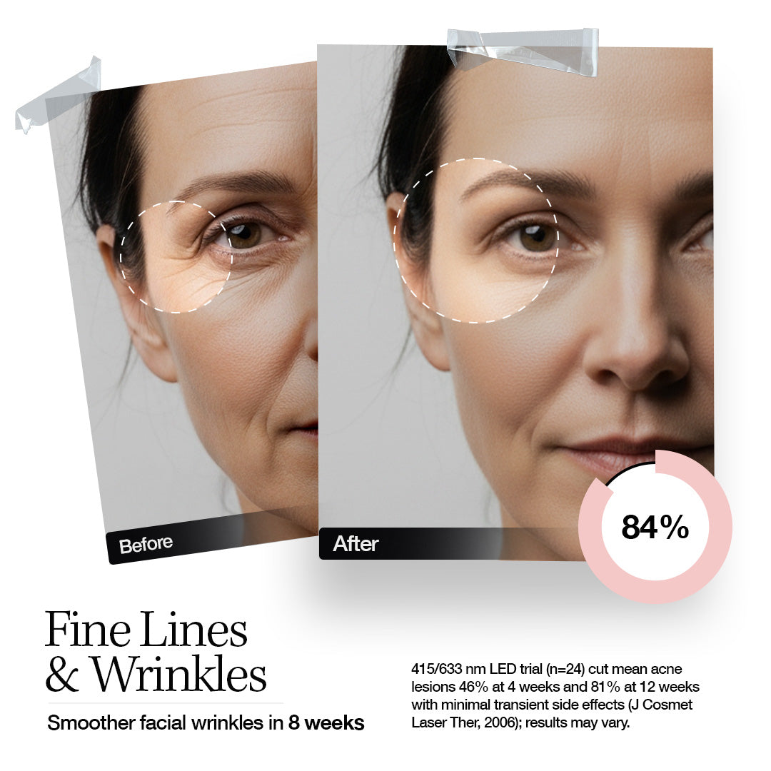 Elle LED Mask Radiance Boost Pro Facewear Pink Colour