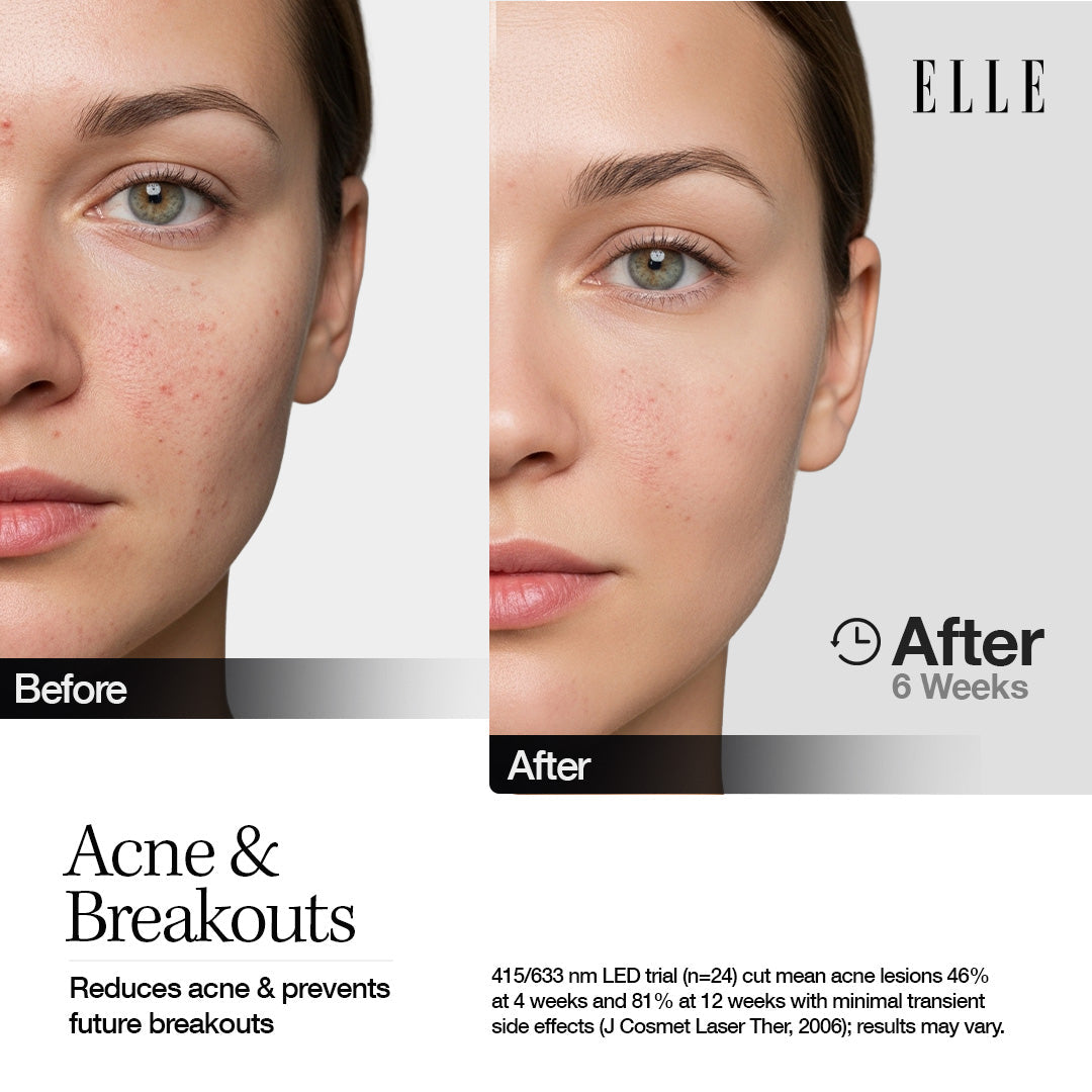 Elle LED Mask Radiance Boost Pro Facewear Pink Colour