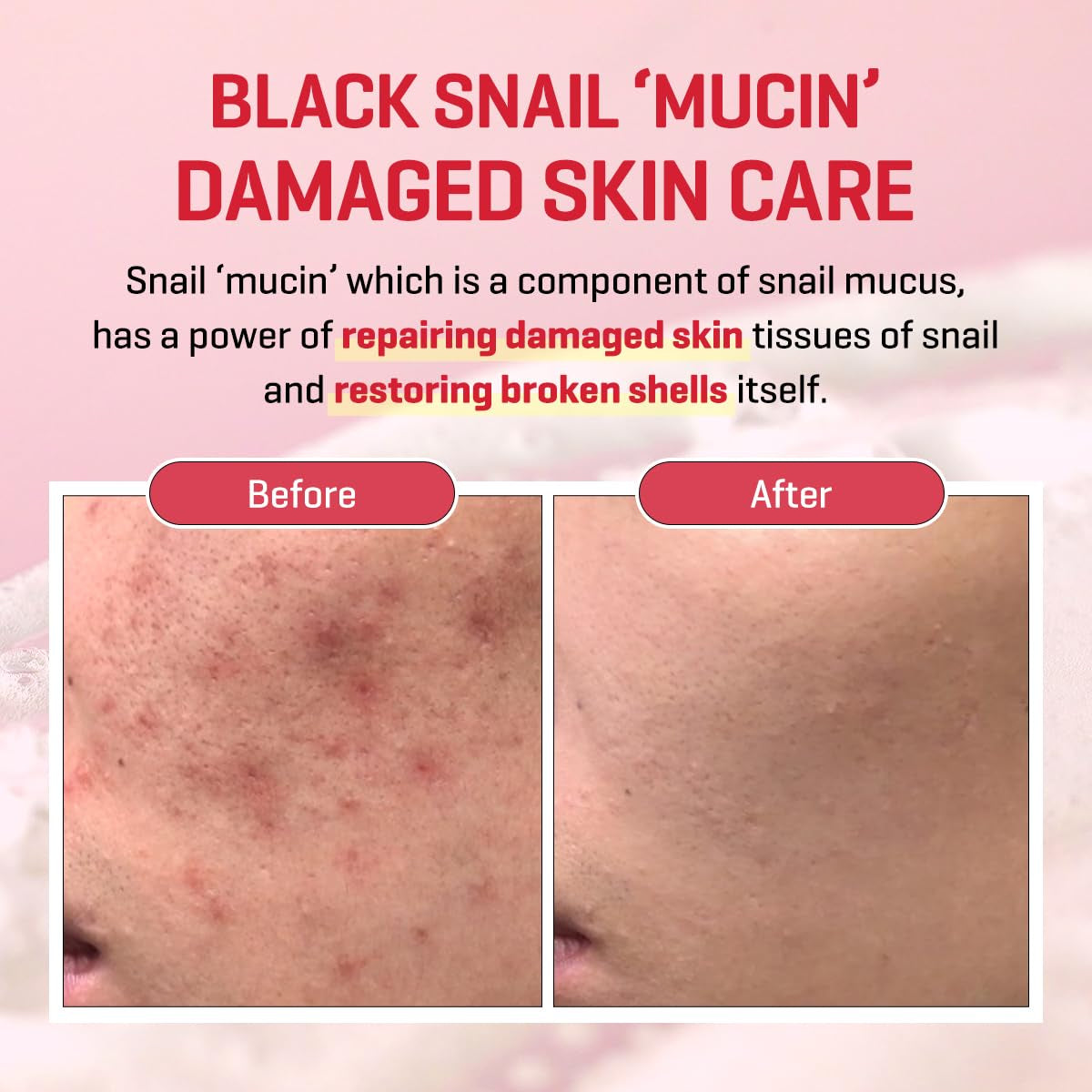 Some By Mi - Snail Truecica Miracle Repair Low pH Gel Cleanser – 100 ML